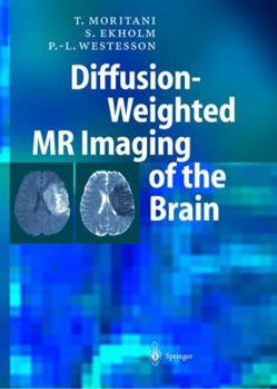 Hardcover Diffusion- Weighted MR Imaging of the Brain Book