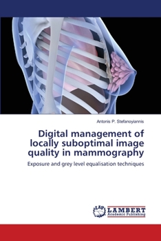 Paperback Digital management of locally suboptimal image quality in mammography Book
