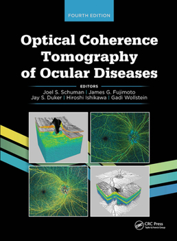 Hardcover Optical Coherence Tomography of Ocular Diseases Book