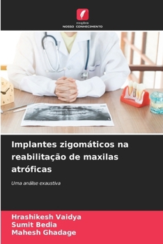 Implantes zigomáticos na reabilitação de maxilas atróficas (Portuguese Edition)