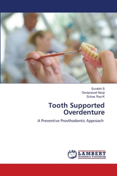 Paperback Tooth Supported Overdenture Book