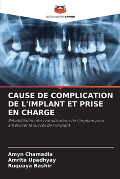 Paperback Cause de Complication de l'Implant Et Prise En Charge [French] Book
