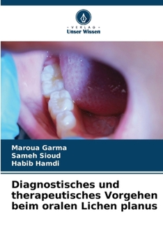 Paperback Diagnostisches und therapeutisches Vorgehen beim oralen Lichen planus [German] Book