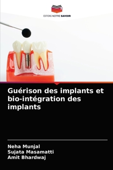 Paperback Guérison des implants et bio-intégration des implants [French] Book