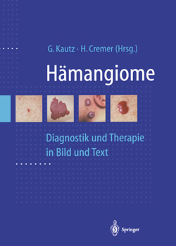 Paperback Hämangiome: Diagnostik Und Therapie in Bild Und Text [German] Book