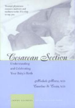 Hardcover Cesarean Section: Understanding and Celebrating Your Baby's Birth Book