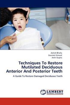 Paperback Techniques To Restore Mutilated Deciduous Anterior And Posterior Teeth Book