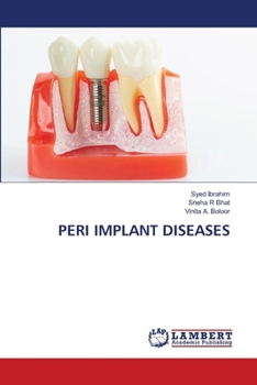 Paperback Peri Implant Diseases Book