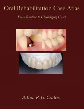 Paperback Oral Rehabilitation Case Atlas: From Routine to Challenging Cases Book