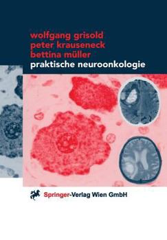 Paperback Praktische Neuroonkologie [German] Book