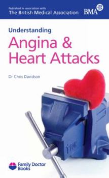 Paperback Understanding Angina & Heart Attacks (Family Doctor Publications) Book