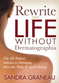 Paperback Rewrite Your Life Without Dermatographia: The All-Natural Solution to Managing Hive-Like Welts and Severe Itching Book