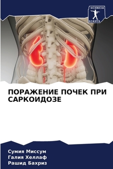 Paperback ПОРАЖЕНИЕ ПОЧЕК ПРИ САРК [Russian] Book