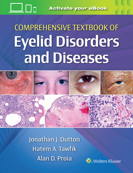 Hardcover Comprehensive Textbook of Eyelid Disorders and Diseases Book
