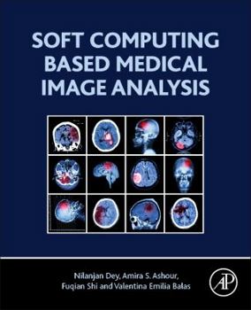 Paperback Soft Computing Based Medical Image Analysis Book