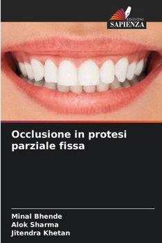 Occlusione in protesi parziale fissa