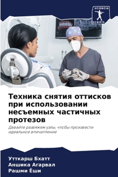 Техника снятия оттисков