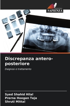 Paperback Discrepanza antero-posteriore [Italian] Book