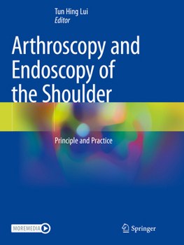 Paperback Arthroscopy and Endoscopy of the Shoulder: Principle and Practice Book