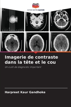 Paperback Imagerie de contraste dans la tête et le cou [French] Book