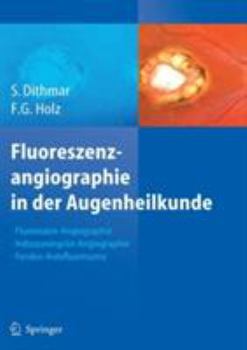 Hardcover Fluoreszenzangiographie in Der Augenheilkunde: Fluoreszein-Angiographie, Indozyaningrün-Angiographie Und Fundus-Autofluoreszenz [German] Book