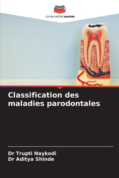 Classificazione delle malattie parodontali