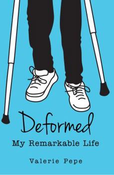 Paperback Deformed: My Remarkable Life Book