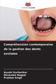 Compréhension contemporaine de la gestion des dents avulsées (French Edition)
