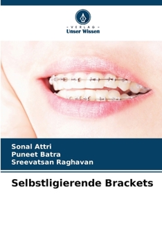 Paperback Selbstligierende Brackets [German] Book