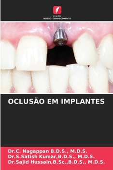 Paperback Oclusão Em Implantes [Portuguese] Book