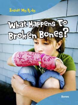 Hardcover What Happens to Broken Bones?: Bones Book