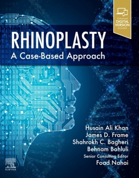 Hardcover Rhinoplasty: A Case-Based Approach Book