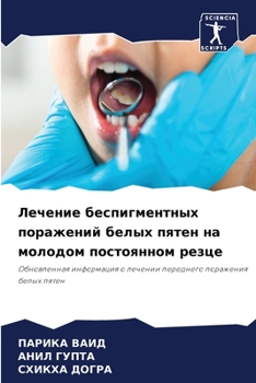 Paperback Лечение беспигментных п& [Russian] Book