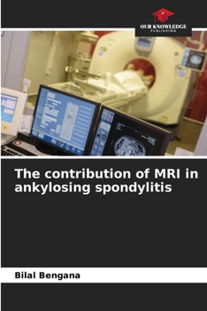 Paperback The contribution of MRI in ankylosing spondylitis Book
