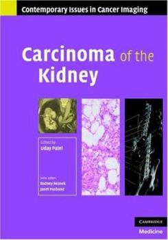 Hardcover Carcinoma of the Kidney Book