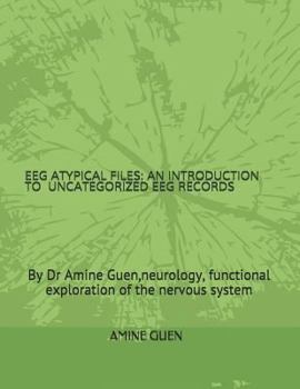 Paperback Eeg Atypical Files: An Introduction to Uncategorized Eeg Records Book