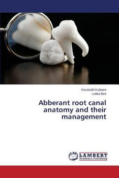 Paperback Abberant Root Canal Anatomy and Their Management Book