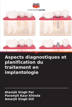 Aspects diagnostiques et planification du traitement en implantologie (French Edition)