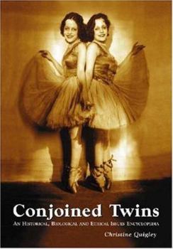 Paperback Conjoined Twins: An Historical, Biological and Ethical Issues Encyclopedia Book