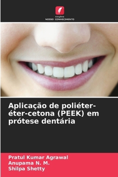 Paperback Aplicação de poliéter-éter-cetona (PEEK) em prótese dentária [Portuguese] Book