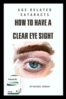 Paperback Age related cataracts: How to have a clear eye sight Book