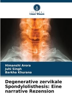 Paperback Degenerative zervikale Spondylolisthesis: Eine narrative Rezension [German] Book