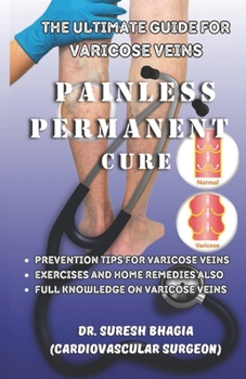 Paperback The ultimate guide for Varicose veins: painless, permanent cure and tips to prevent varicose veins Book