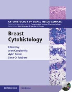 Breast Cytohistology - Book  of the Cytohistology of Small Tissue Samples