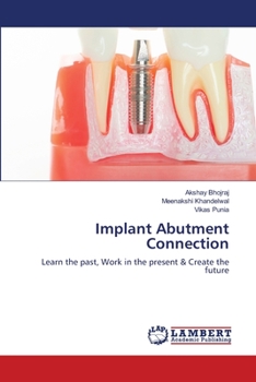 Paperback Implant Abutment Connection Book