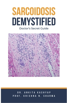 Paperback Sarcoidosis Demystified: Doctor's Secret Guide Book