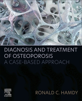 Paperback Diagnosis and Treatment of Osteoporosis: A Case-Based Approach Book