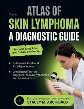 Atlas of Skin Lymphoma: A Diagnostic Guide to Mycosis Fungoides, Sezary Syndrome, Cutaneous T-Cell and B-Cell Lymphomas, Lymphoproliferative Disorders