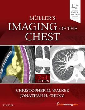 Hardcover Muller's Imaging of the Chest: Expert Radiology Series Book