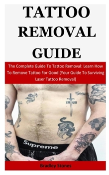 Tattoo Removal Guide: The Complete Guide To Tattoo Removal: Learn How To Remove Tattoo For Good (Your Guide To Surviving Laser Tattoo Removal)